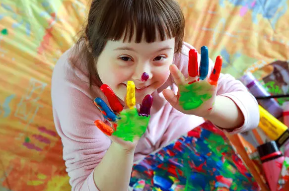 Câmara aprova atendimento ampliado pelo SUS a pessoas com síndrome de&nbsp;Down